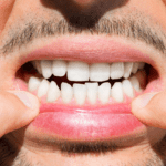 Babské rady na citlivé zuby: Co pomáhá?